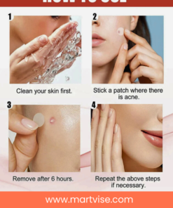 sadoer-pimple-patch-pack-main.jpg – Sadoer pimple patch salicylic acid acne healing hydrocolloid stickers